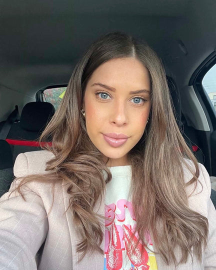 MEET FIONA : "Depuis toujours, ma peau raconte une histoire que je n’ai jamais choisie".
