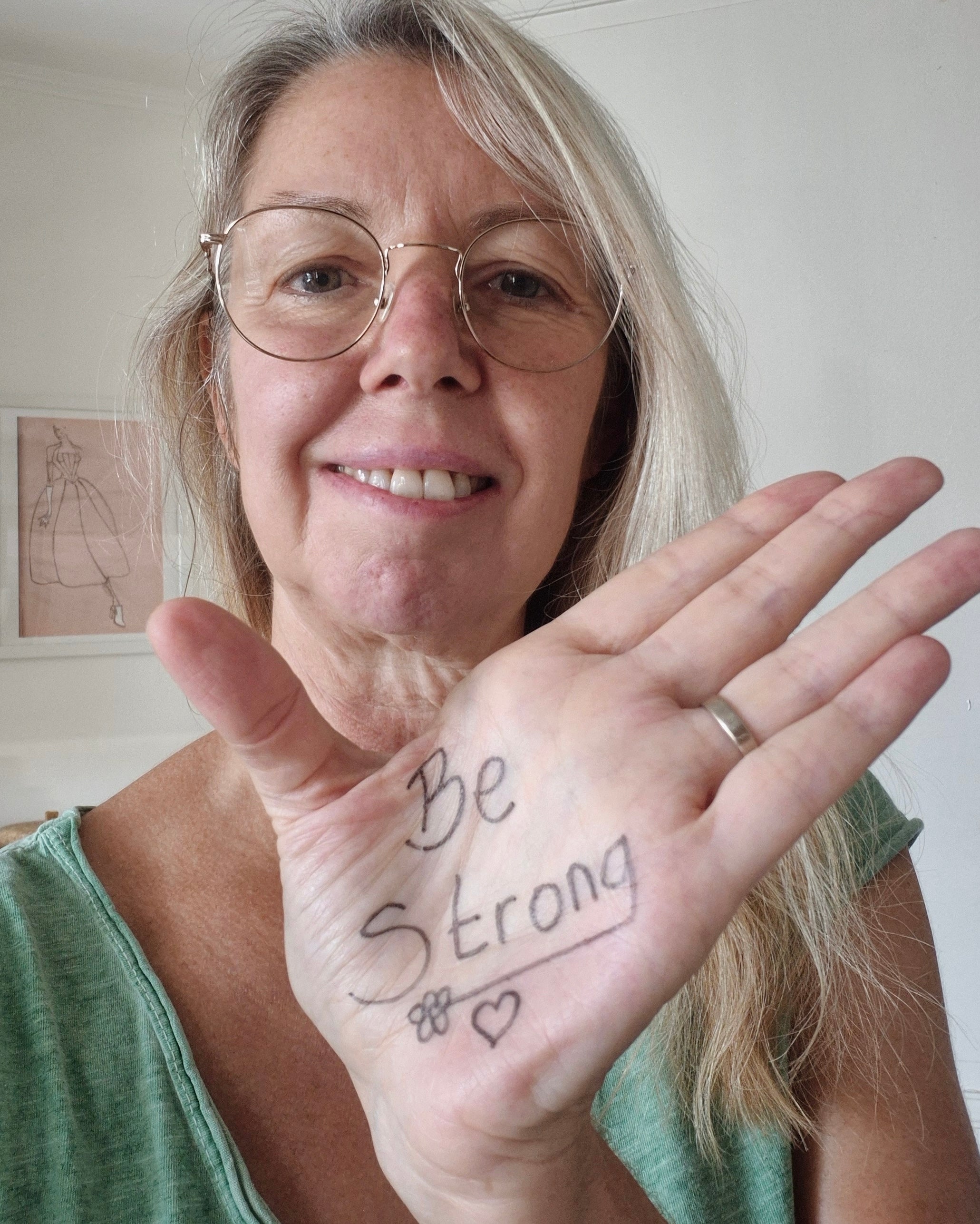 MEET MARIE : "Je vis avec l’eczéma depuis mes premiers souvenirs."