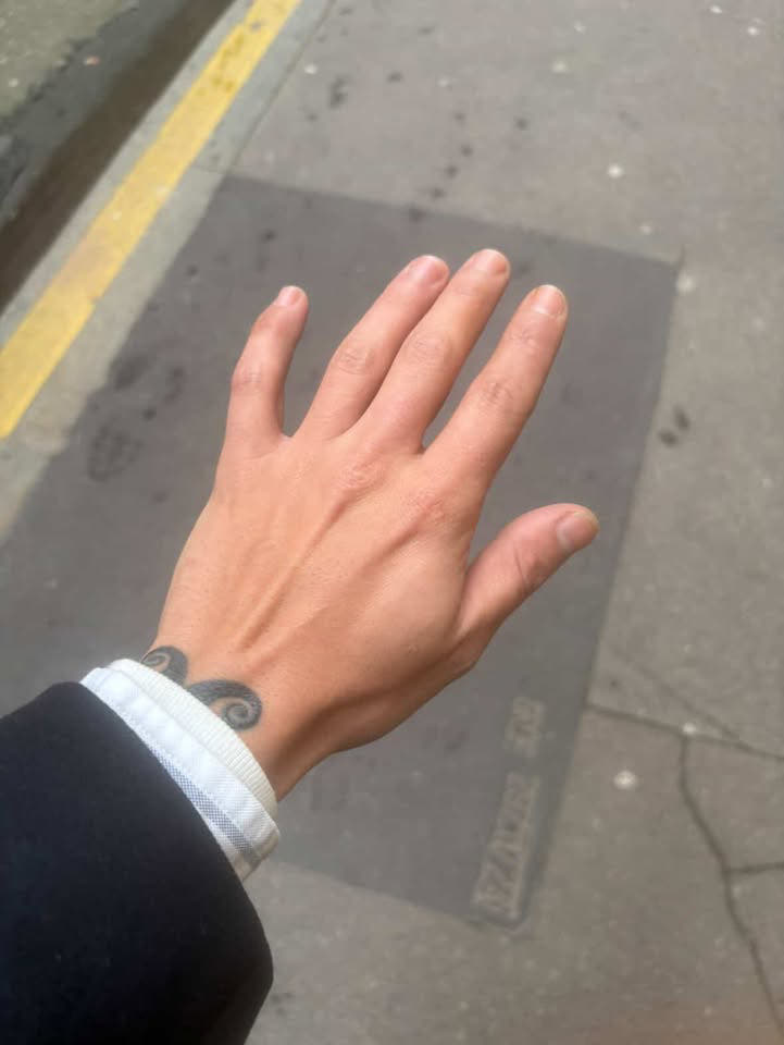 Peau de Valentin après Pomad