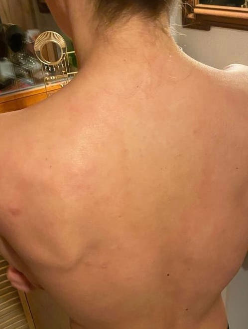 Peau de Charlotte après Pomad