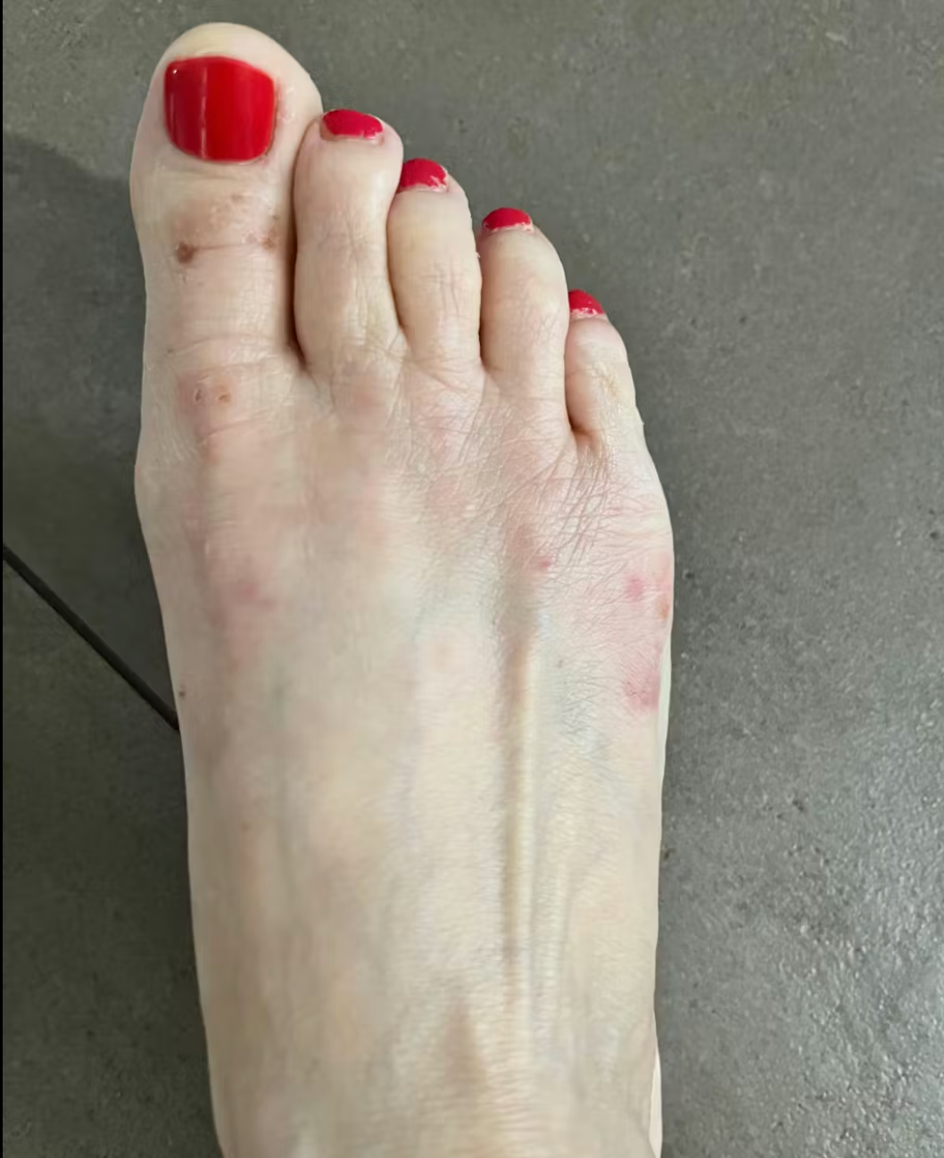 Peau de Daria après Pomad