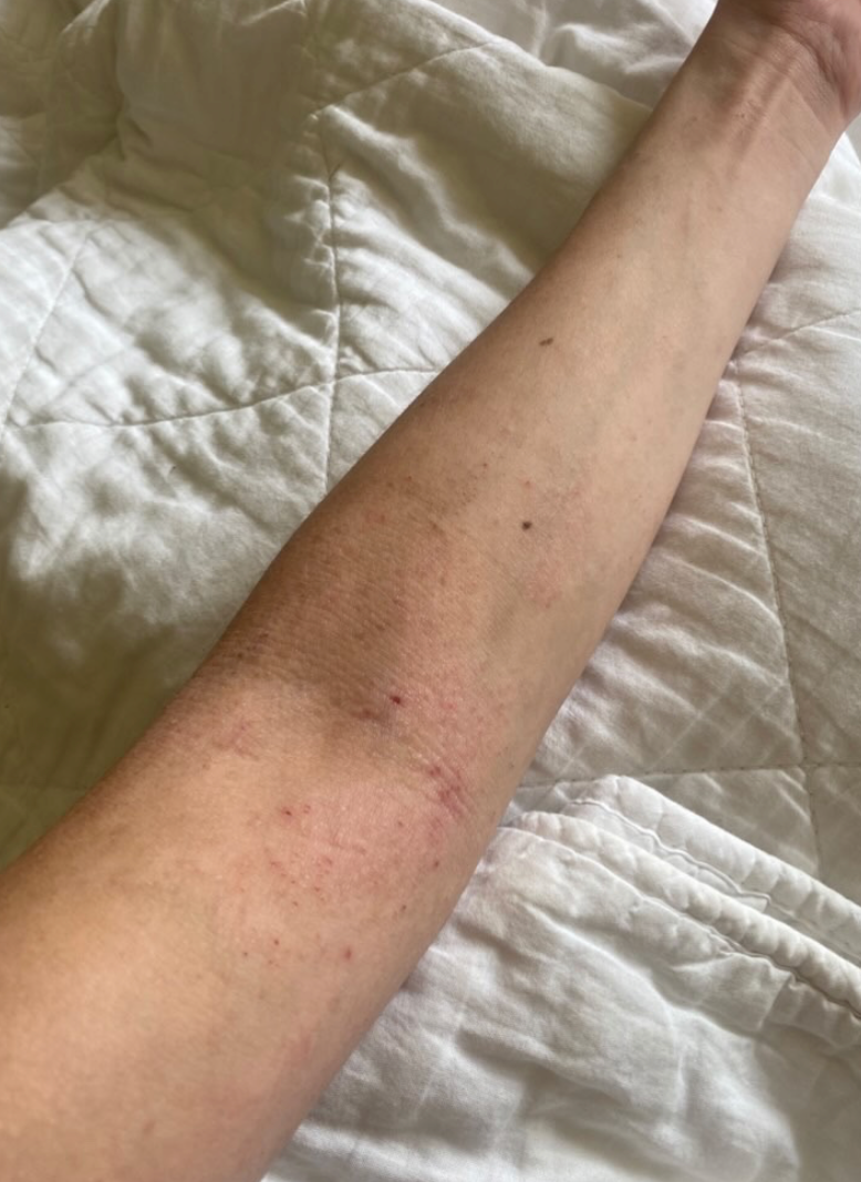 Peau de Carolyn après Pomad