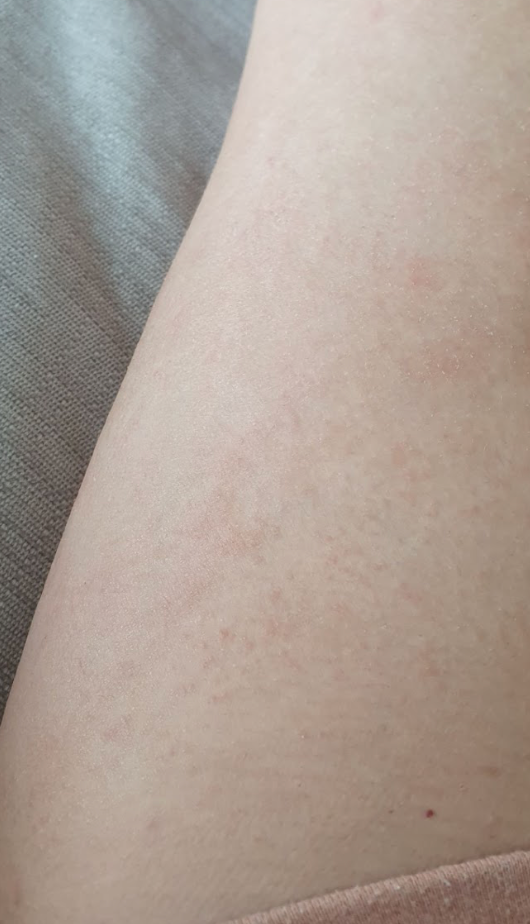Peau de Lauriane après Pomad