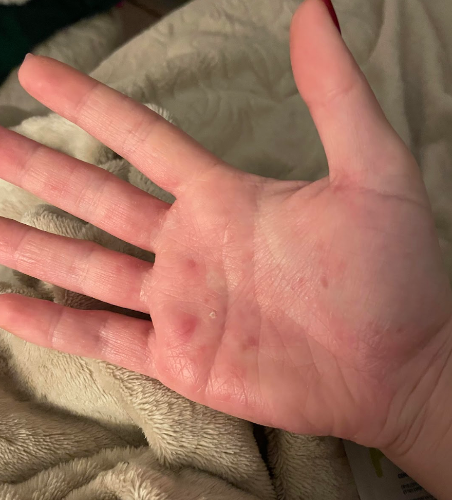 Peau de Marine après Pomad