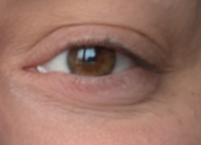Peau de Fanny après Pomad