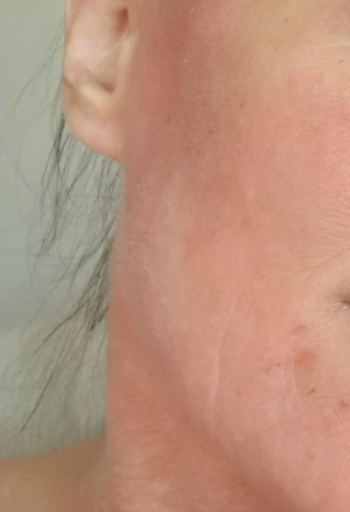 Peau de Natacha après Pomad